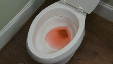 common toilet problems and solutions